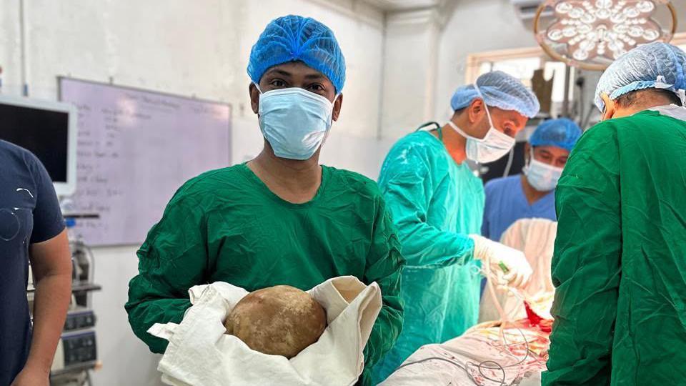Sri Lanka Surgeons Remove Heaviest Bladder Stone Ever