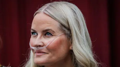 Norway's Crown Princess Successfully Undergoes Lung Transplant, Palace Announces